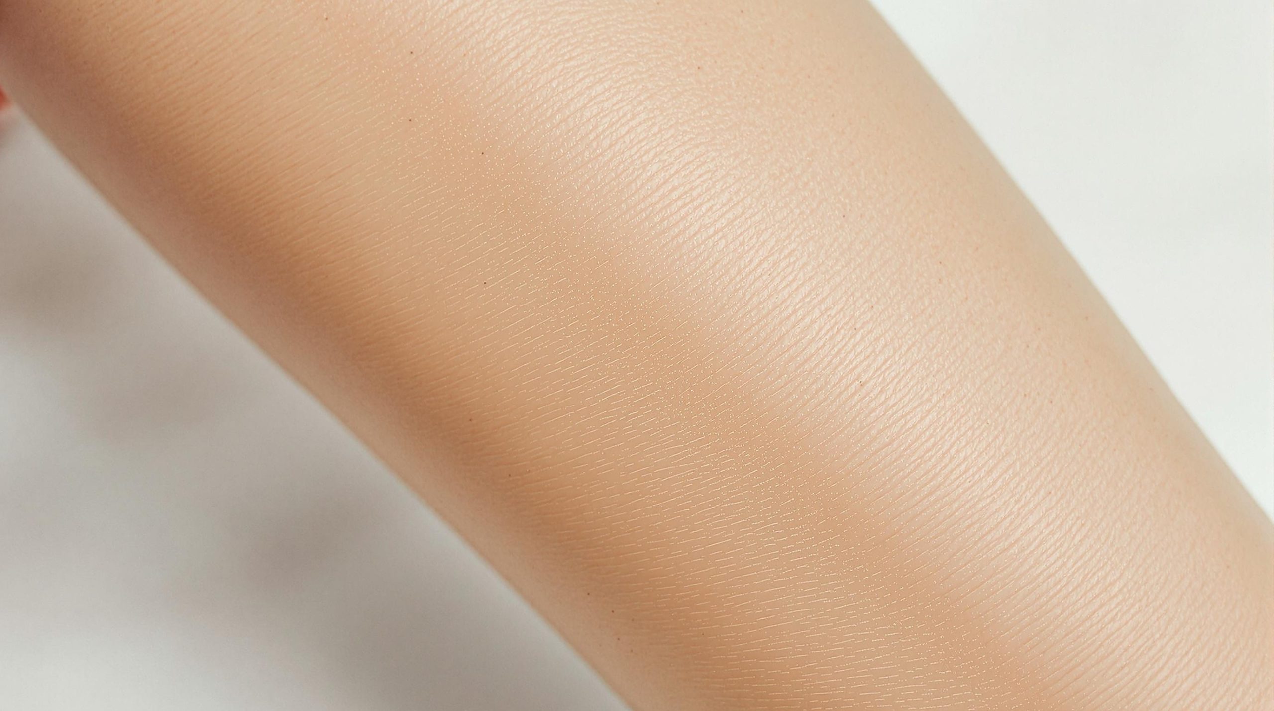 Tout savoir sur les vergetures au niveau des mollets